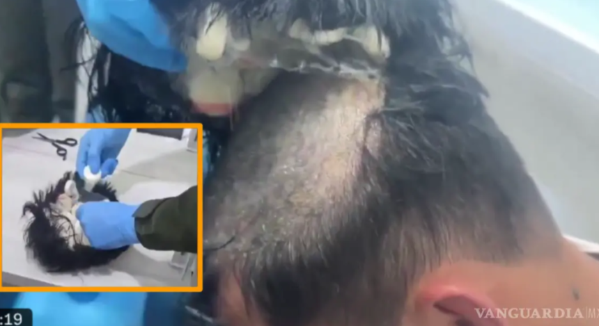 A través de redes sociales se viralizó un video, donde se muestra el ingenio y la creatividad al intentar realizar actividades ilegales, tal es el caso de un sujeto que intentó traficar dosis de droga a través del Aeropuerto Rafael Núñez de la ciudad de Cartagena, Colombia. FOTO: VANGUARDIA