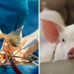 De hecho, previamente, dos hombres recibieron transplantes de corazones de cerdos Foto: Especial