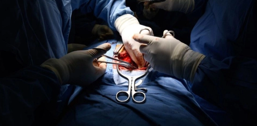 Periodico La Jornada /Trasplante de hígado, en imagen de archivo. Foto Cuartoscuro