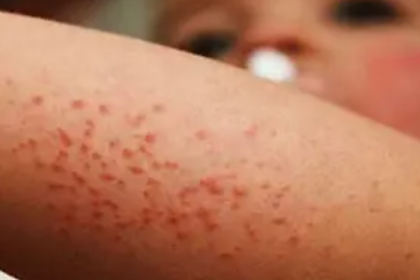 Cortesía / Secretaría de Salud