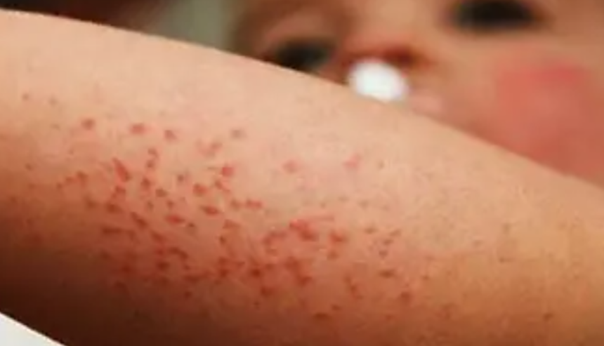 Cortesía / Secretaría de Salud